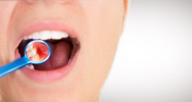 Une patiente de dentiste ouvre la bouche