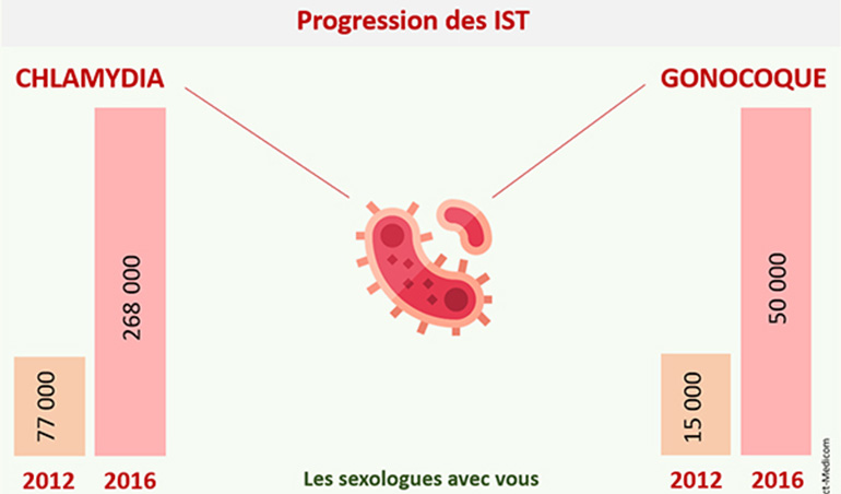 Progression IST