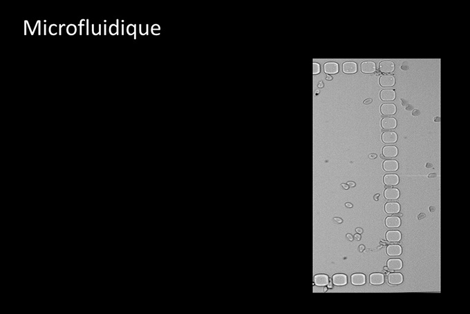 P13 Globules rouges Labroom