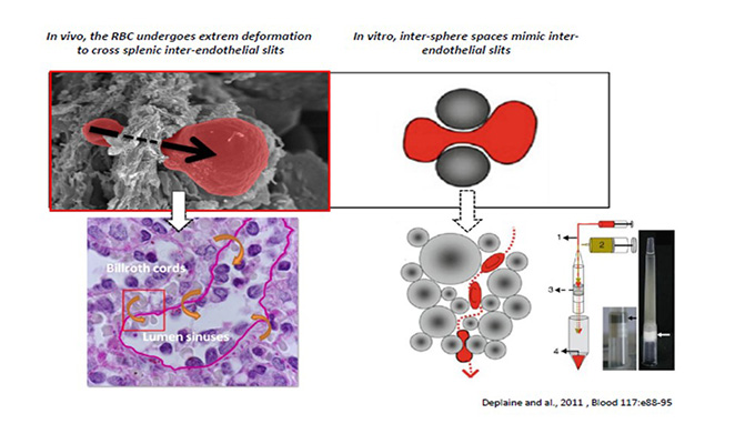 P14 Globules rouges Labroom